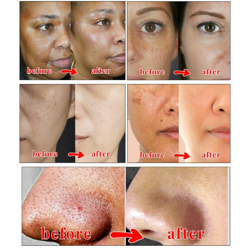 Lot de 2 Savons Kojic