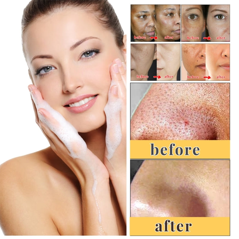 Lot de 2 Savons Kojic