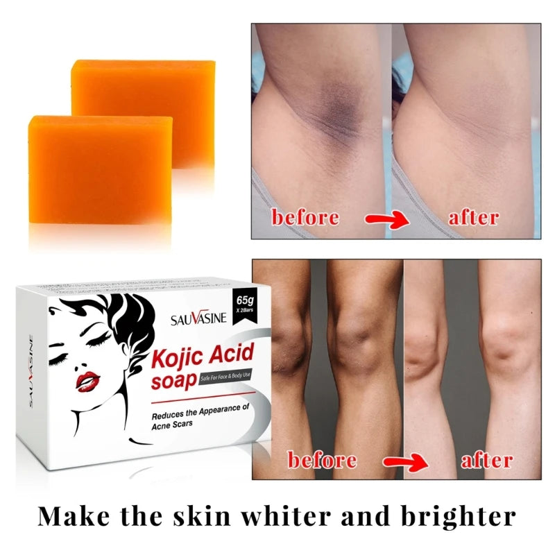 Lot de 2 Savons Kojic
